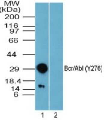 Western Blot: BCR [p Tyr276] Antibody [NBP2-24460]